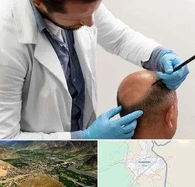 کاشت مو به روش تکثیری در اسدآباد