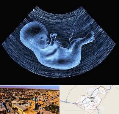 دکتر متخصص غربال گری در بافق
