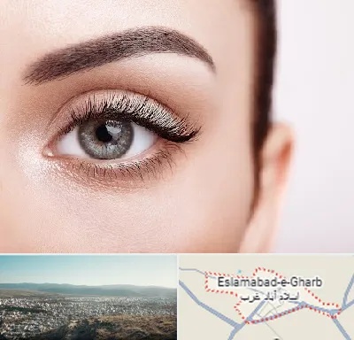 فوق تخصص عنبیه در اسلام آباد غرب