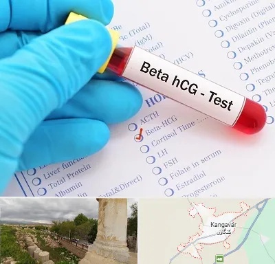 آزمایشگاه بارداری در کنگاور