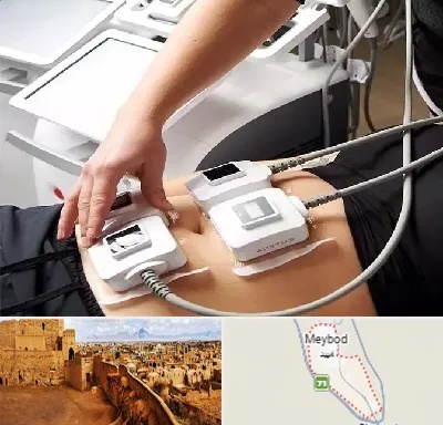 ترواسکالپ در میبد
