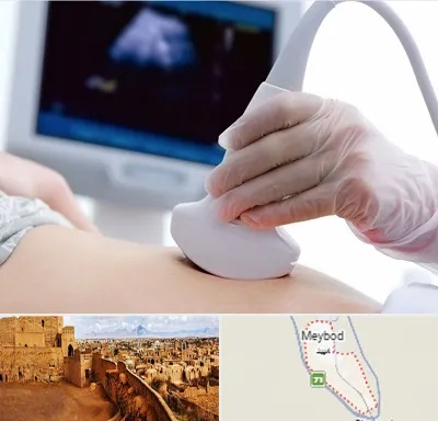 سونوگرافی در میبد