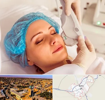 اکسنت در بافق