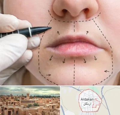 عمل سانترال لب در اردکان