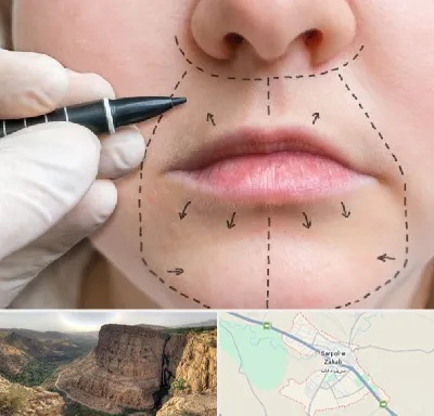عمل سانترال لب در سرپل ذهاب