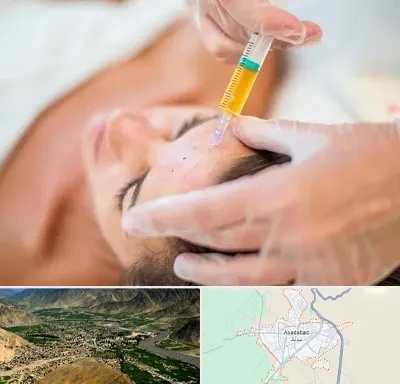 پی آر پی در اسدآباد