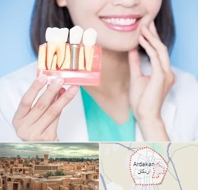 متخصص ایمپلنت در اردکان