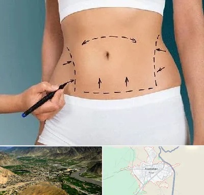 دکتر طب سنتی برای لاغری در اسدآباد