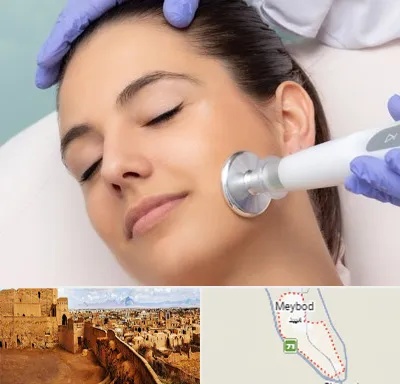 پلاسما جت در میبد