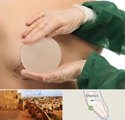 جراحی پروتز سینه در میبد