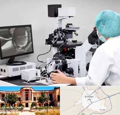 آزمایشگاه اسپرموگرام در خمین