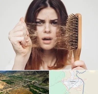 دکتر ریزش مو در اسدآباد