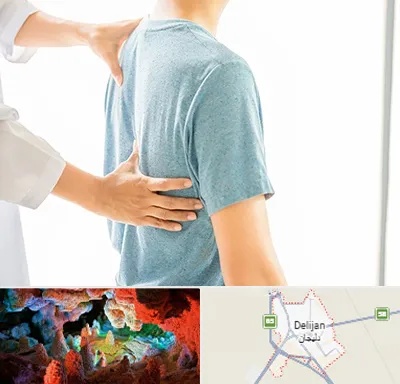دکتر سیاتیک در دلیجان
