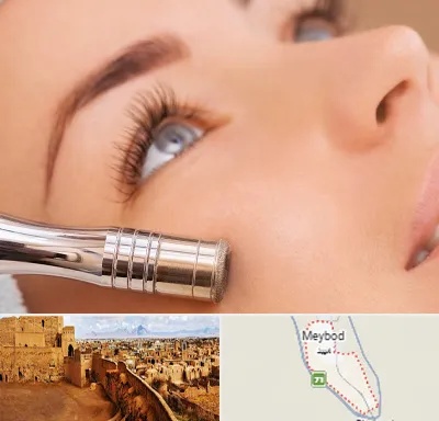 میکرودرم در میبد