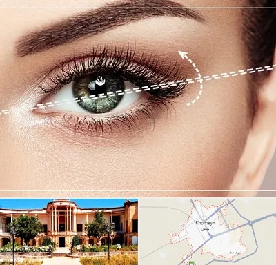 جراحی چشم گربه ای در خمین