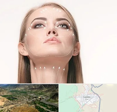 لیفت صورت با نخ در اسدآباد