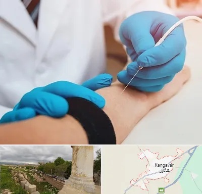 مرکز نوار عصب و عضله در کنگاور
