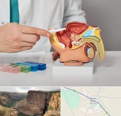 دکتر اورولوژی در سرپل ذهاب