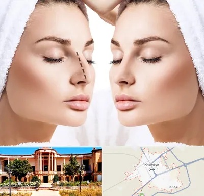 عمل بینی در خمین