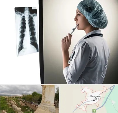 دکتر سرطان ریه در کنگاور