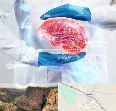 دکتر مغز و اعصاب در سرپل ذهاب
