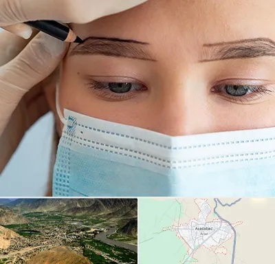 کاشت ابرو در اسدآباد