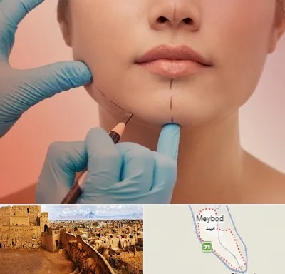 دکتر زیبایی خانم در میبد