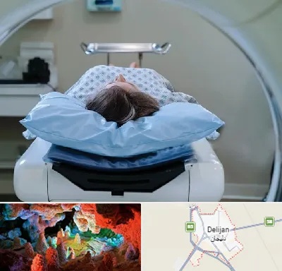 رادیولوژی فک و صورت در دلیجان