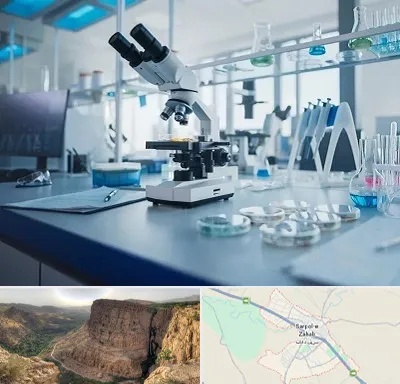 آزمایشگاه تیروئید در سرپل ذهاب