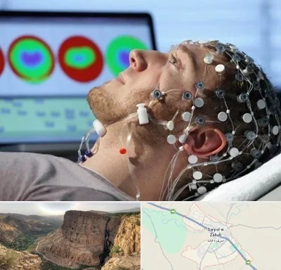 مرکز نوار مغز در سرپل ذهاب