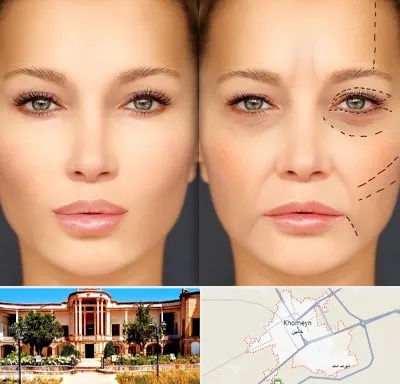 متخصص زیبایی چشم در خمین