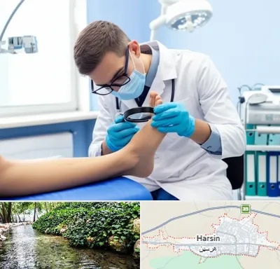 درمان زخم پای دیابتی در هرسین
