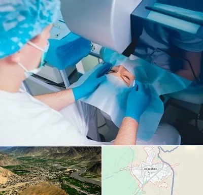 دکتر عمل لازک چشم در اسدآباد