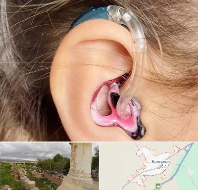 ساخت قالب سمعک در کنگاور