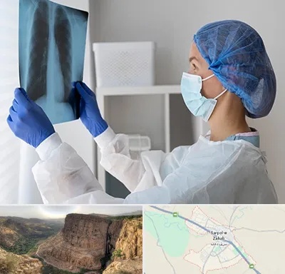 جراح سرطان مغز و استخوان در سرپل ذهاب