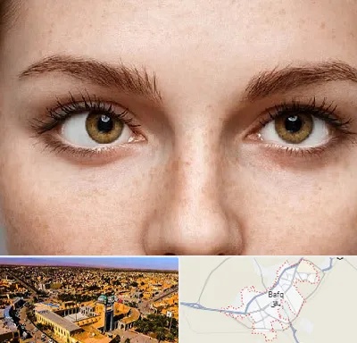 متخصص انحراف چشم در بافق