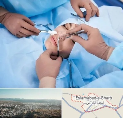 عمل بینی فانتزی در اسلام آباد غرب