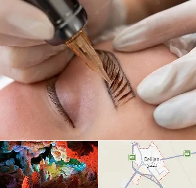 میکروبلیدینگ در دلیجان