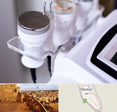 مرکز لاغری با کویتیشن در میبد