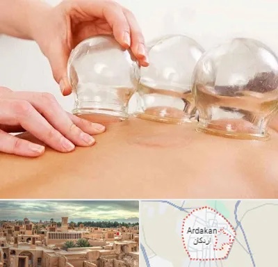 بادکش درمانی در اردکان