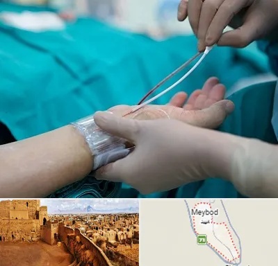 آنژیوگرافی در میبد