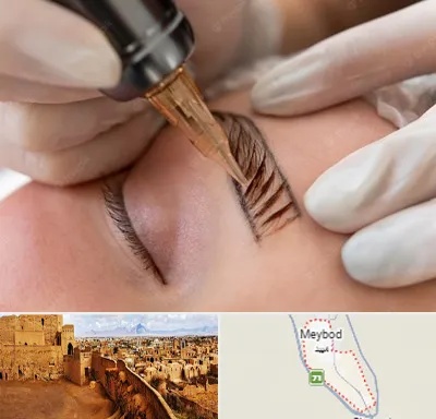 میکروبلیدینگ در میبد