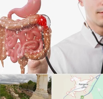 دکتر سرطان روده بزرگ در کنگاور