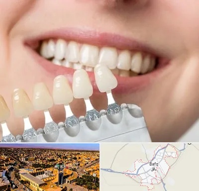 مرکز کامپوزیت دندان در بافق