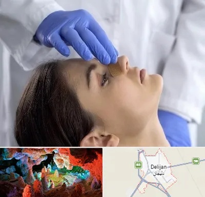 عمل بینی عروسکی در دلیجان