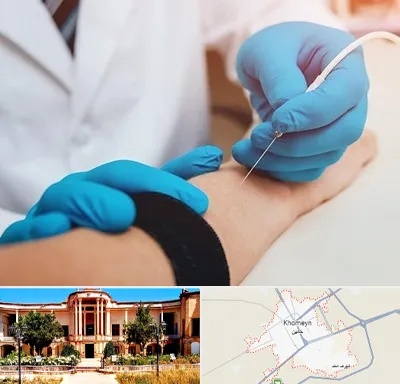 مرکز نوار عصب و عضله در خمین