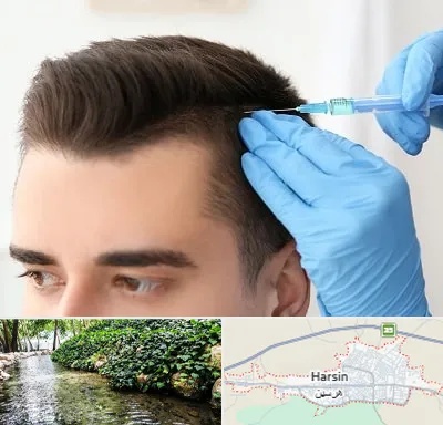 مزوتراپی مو در هرسین