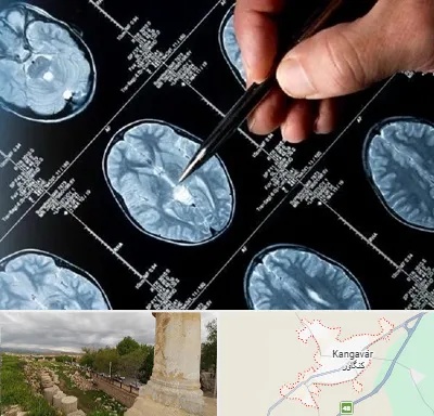 دکتر تشنج در کنگاور