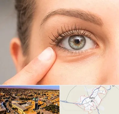 جراح پف چشم در بافق