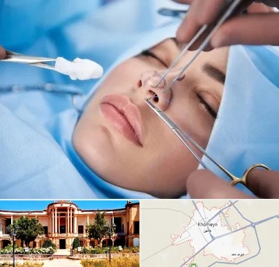 عمل ترمیمی بینی در خمین